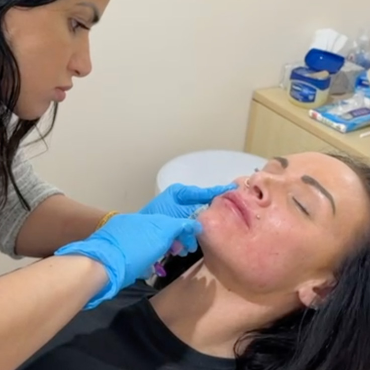 CHIN DIMPLING (1)